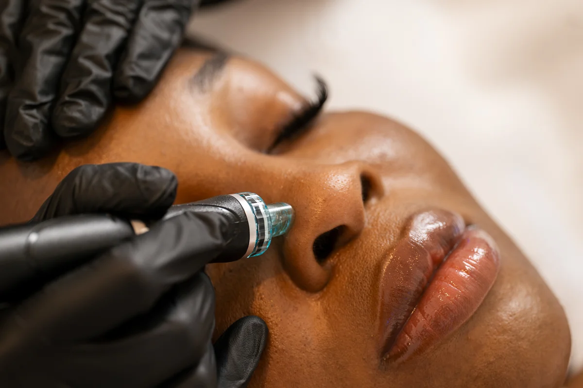 HydraFacial® Behandlung im Gesicht bei CAPEGOLD in Berlin